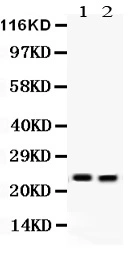 Anti-Lipocalin-2 antibody used in Western Blot (WB). GTX03729