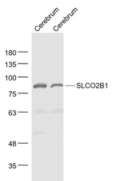 Anti-SLCO2B1 antibody used in Western Blot (WB). GTX03731
