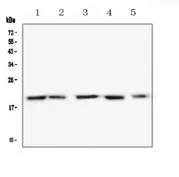 Anti-BCMA antibody used in Western Blot (WB). GTX03735