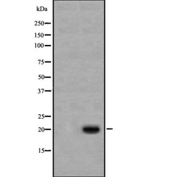 Anti-Caspase 1 (cleaved Asp297) antibody used in Western Blot (WB). GTX03738