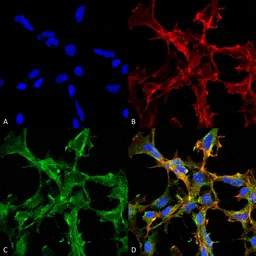 Anti-Citrulline antibody [2D3.1] used in Immunocytochemistry/ Immunofluorescence (ICC/IF). GTX03741