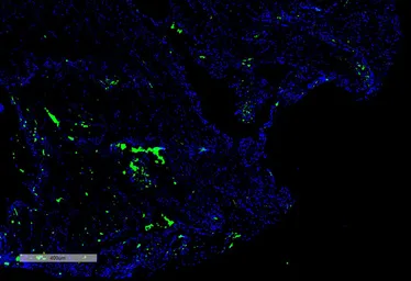 Anti-Citrulline antibody [2D3.1] used in Immunohistochemistry (IHC). GTX03741