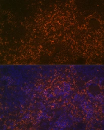 Anti-CD38 antibody used in IHC (Paraffin sections) (IHC-P). GTX03746