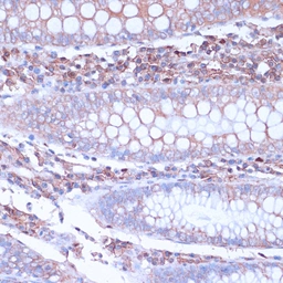 Anti-CD38 antibody used in IHC (Paraffin sections) (IHC-P). GTX03746