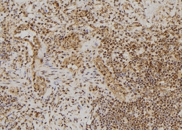 Anti-BRCA2 (phospho Ser2095) antibody used in IHC (Paraffin sections) (IHC-P). GTX03783