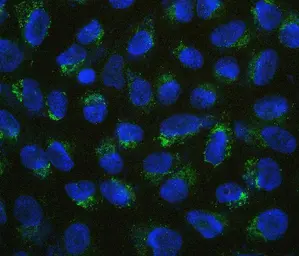Anti-B7-H4 antibody used in Immunocytochemistry/ Immunofluorescence (ICC/IF). GTX03785