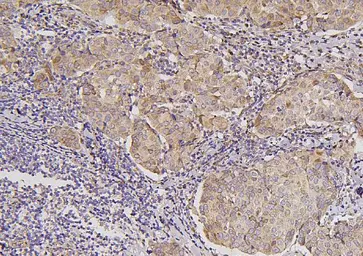 Anti-B7-H4 antibody used in IHC (Paraffin sections) (IHC-P). GTX03785