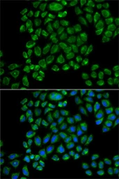 Anti-GluR3 antibody used in Immunocytochemistry/ Immunofluorescence (ICC/IF). GTX03787