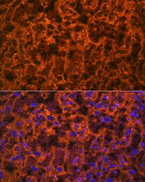 Anti-PLGF antibody [GT1358] used in IHC (Paraffin sections) (IHC-P). GTX03799