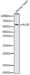 Anti-PLGF antibody [GT1358] used in Western Blot (WB). GTX03799