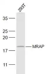 Anti-MRAP antibody used in Western Blot (WB). GTX03803