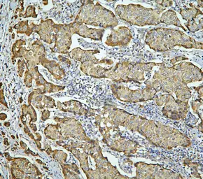 Anti-LONP1 antibody used in IHC (Paraffin sections) (IHC-P). GTX03806