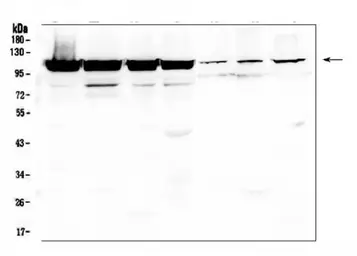Anti-LONP1 antibody used in Western Blot (WB). GTX03806