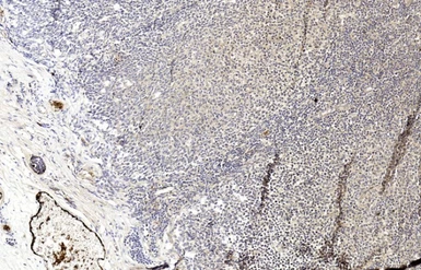 Anti-MLKL antibody used in IHC (Paraffin sections) (IHC-P). GTX03807
