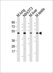Anti-MLKL antibody used in Western Blot (WB). GTX03807