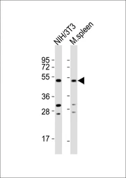 Anti-MLKL antibody used in Western Blot (WB). GTX03807