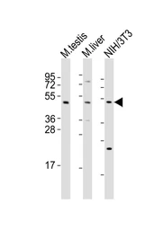 Anti-MLKL antibody used in Western Blot (WB). GTX03807