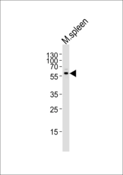 Anti-MLKL antibody used in Western Blot (WB). GTX03807
