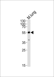 Anti-MLKL antibody used in Western Blot (WB). GTX03807