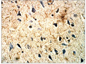 Anti-5-HT2C receptor antibody used in IHC (Paraffin sections) (IHC-P). GTX03808