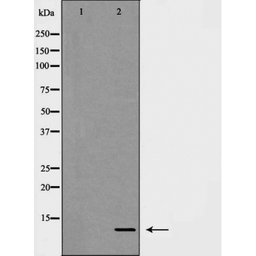 Anti-CXCL1 / GRO alpha antibody used in Western Blot (WB). GTX03810