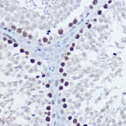 Anti-Aurora B antibody used in IHC (Paraffin sections) (IHC-P). GTX03922