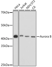 Anti-Aurora B antibody used in Western Blot (WB). GTX03922
