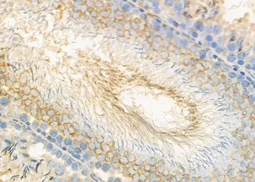 Anti-COL9A1 antibody used in IHC (Paraffin sections) (IHC-P). GTX03923