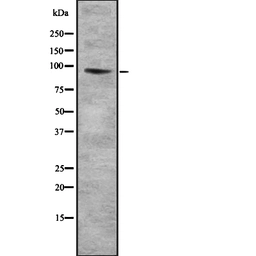 Anti-COL9A1 antibody used in Western Blot (WB). GTX03923