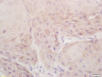 Anti-DSPP antibody used in IHC (Paraffin sections) (IHC-P). GTX04076