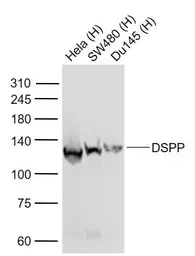 Anti-DSPP antibody used in Western Blot (WB). GTX04076