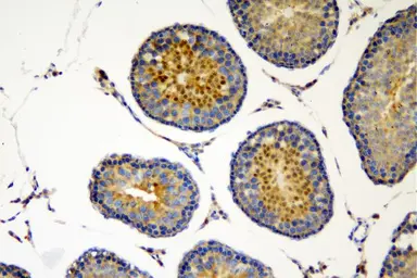 Anti-SOX6 antibody used in IHC (Paraffin sections) (IHC-P). GTX04085