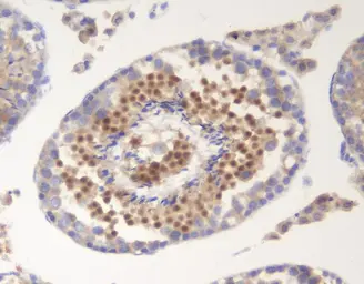 Anti-SOX6 antibody used in IHC (Paraffin sections) (IHC-P). GTX04085