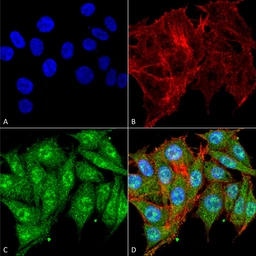 Anti-IGF1 antibody used in Immunocytochemistry/ Immunofluorescence (ICC/IF). GTX04087