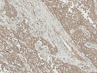 Anti-IGF1 antibody used in IHC (Paraffin sections) (IHC-P). GTX04087