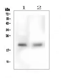Anti-TMEM166 antibody used in Western Blot (WB). GTX04091