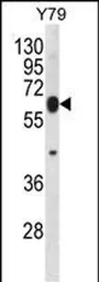 Anti-RNF180 antibody used in Western Blot (WB). GTX04092