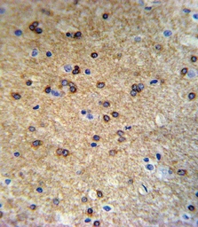 Anti-ATP7b antibody used in IHC (Paraffin sections) (IHC-P). GTX04095