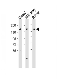 Anti-ATP7b antibody used in Western Blot (WB). GTX04095