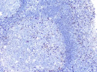 Anti-PTP1B antibody used in IHC (Paraffin sections) (IHC-P). GTX04098
