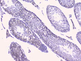 Anti-PTP1B antibody used in IHC (Paraffin sections) (IHC-P). GTX04098
