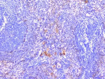 Anti-PTP1B antibody used in IHC (Paraffin sections) (IHC-P). GTX04098