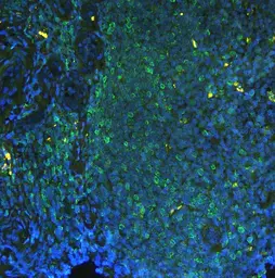Anti-PTP1B antibody used in IHC (Paraffin sections) (IHC-P). GTX04098