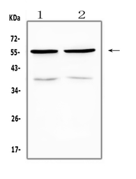 Anti-PTP1B antibody used in Western Blot (WB). GTX04098