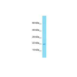 Anti-ATP6V0E2 antibody used in Western Blot (WB). GTX04102