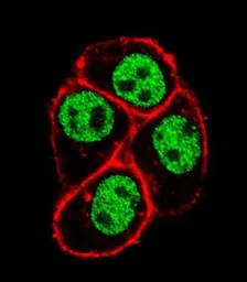 Anti-CDC73 antibody used in Immunocytochemistry/ Immunofluorescence (ICC/IF). GTX04105