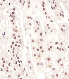 Anti-CDC73 antibody used in IHC (Paraffin sections) (IHC-P). GTX04105