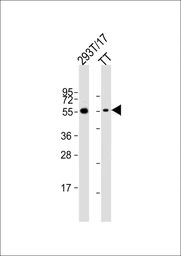 Anti-CDC73 antibody used in Western Blot (WB). GTX04105