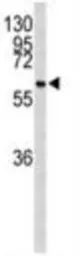 Anti-CDC73 antibody used in Western Blot (WB). GTX04105