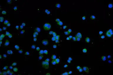 Anti-VR1/ TRPV1 antibody used in Immunocytochemistry/ Immunofluorescence (ICC/IF). GTX04108